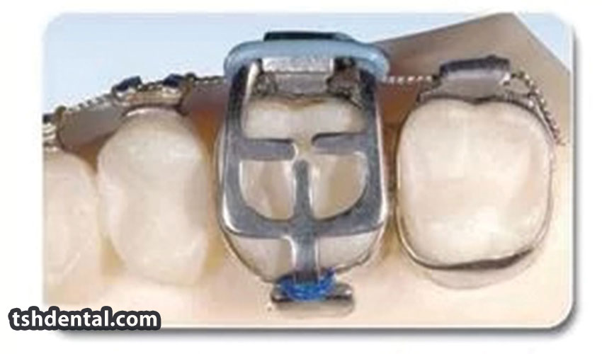 بایت رایزر چیست؟ 1 بایت رایزر