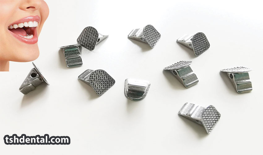 لینگوال باتن