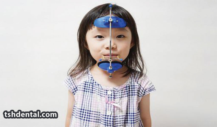 فیس ماسک ارتودنسی