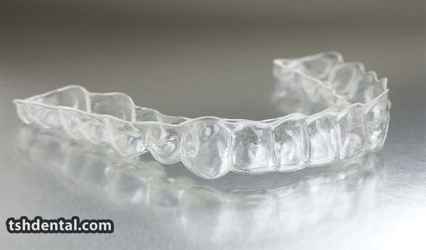 شیت ارتودنسی دندان چیست؟ 1 شیت ارتودنسی