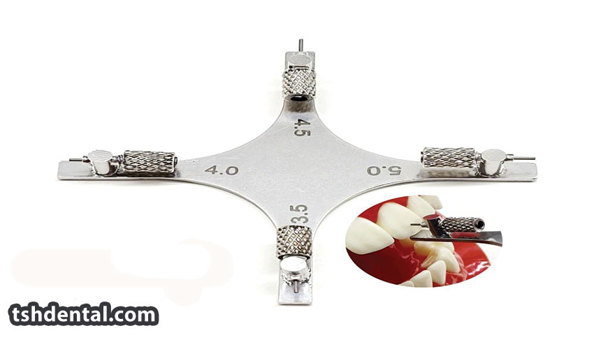 گیج ارتودنسی چیست؟ 2 گیج ارتودنسی