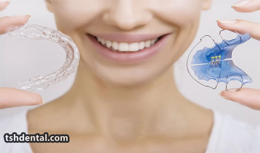 شیت ارتودنسی دندان چیست؟ 2 شیت ارتودنسی